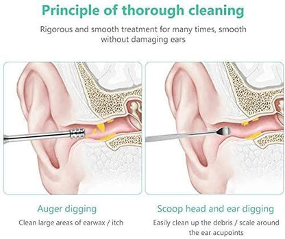 Earwaxio™ 6 Pieces Stainless Steel Ear Wax Removal Kit